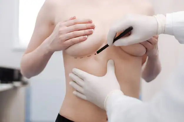 Breast Aesthetics in Turkey 45 Breast Augmentation turkey in istanbul cost